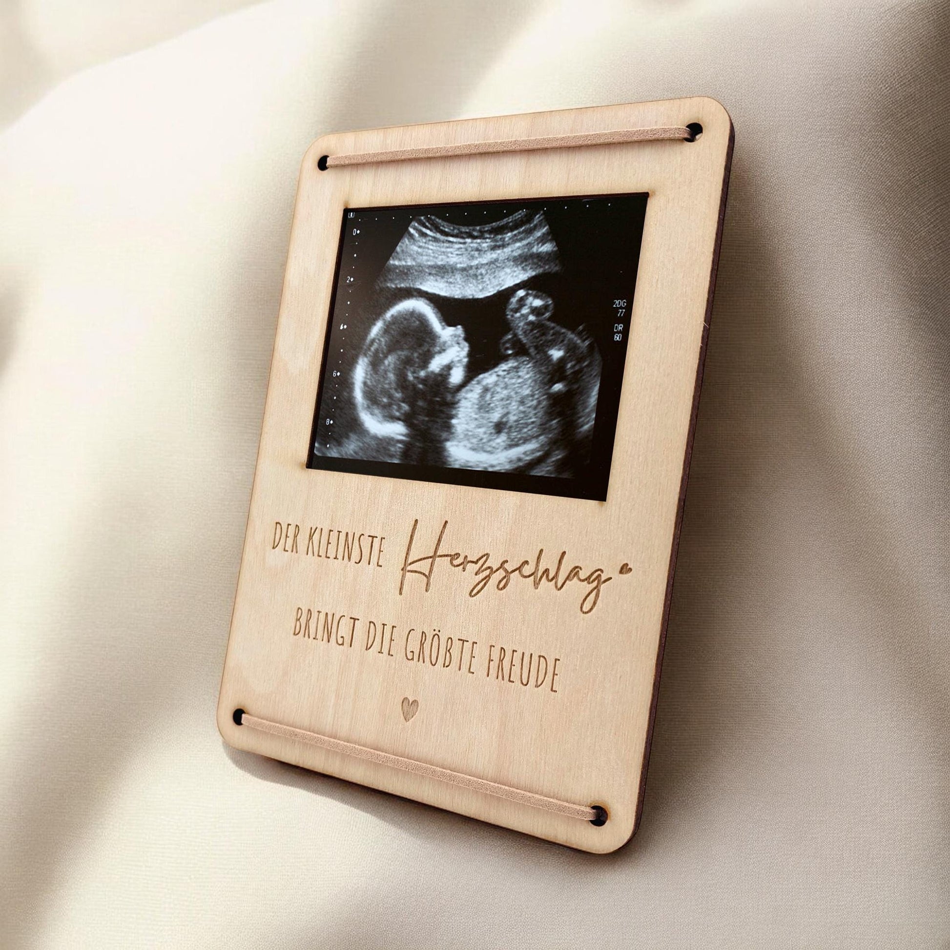 Schwangerschaft verkünden personalisierter Ultraschallbild Bilderrahmen Ultraschall Holzrahmen Geschenk Schwangerschaftsverkündung 12x17 cm